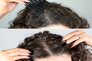 How to Remove Scalp Build Up